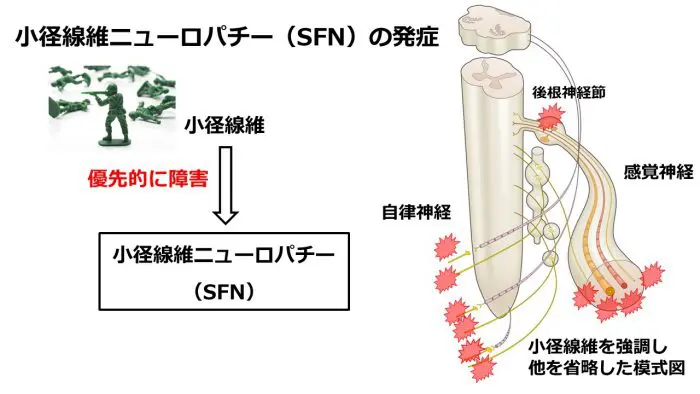 末梢神経障害 (神経内科Clinical Questions &amp; Pearls) 815oRqYSO0L._UF350,350_QL50_.jpg